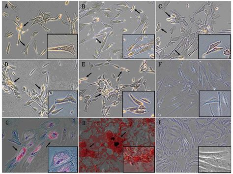 Characterization Of Placenta Derived Mesenchymal Stem Cells Cultured In