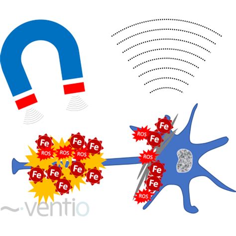 QSM Quantification de la susceptibilité magnétique Ventio