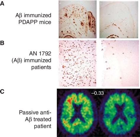 Figure 5 from Treatment strategies targeting amyloid β-protein ...