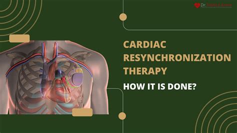 Cardiac Resynchronization Therapy How It Is Done