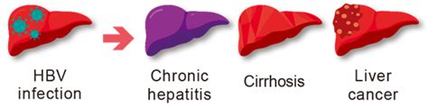 Hepatitis B Liver