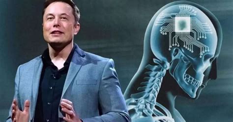 Musk Anuncia Implantação De 1º Chip Cerebral Em Humanos