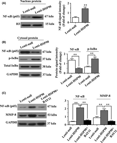 Hsp90 Inhibition Suppresses Inflammatory Response And Reduces Carotid