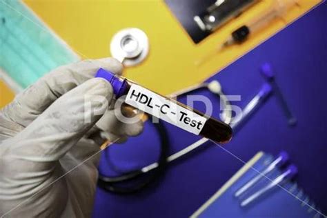 Photograph HDL C Test With Blood Sample Top View Isolated On Color