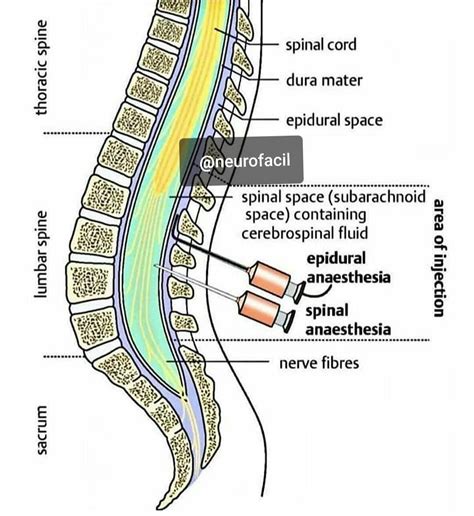 Querido En El Nombre Alojamiento Anatomia Espacio Epidural Bostezando