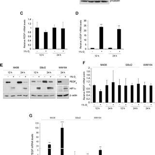 Autophagy Is Involved In Downregulation Of PEDF By Hypoxia In Melanoma