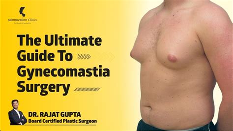 The Ultimate Guide To Gynecomastia Surgery Man Boobs का इलाज Dr Rajat Gupta Skinnovation