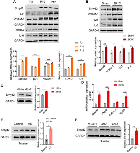 Histone Methyltransferase Smyd2 Drives Vascular Aging By Its Enhancer