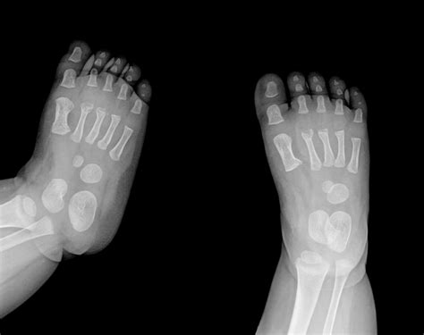 Why Choosing Healthy Shoes for Kids Matters! — Healthy Feet Alliance