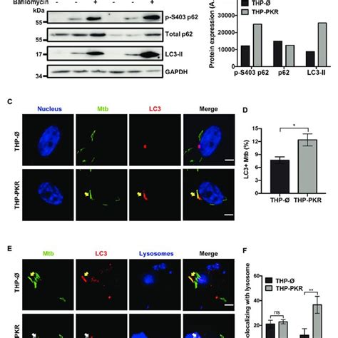 PKR Expression Alters Cytokine Production By Macrophages During M