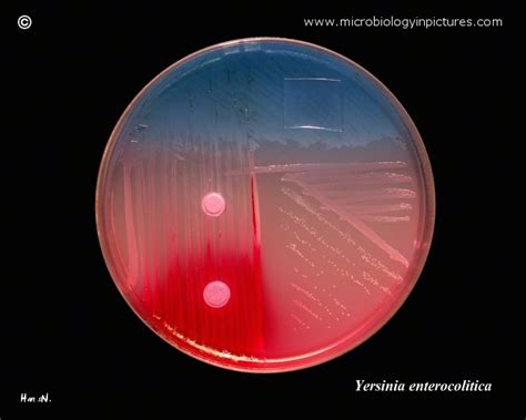 yersinia enterocolitica  endo   biochemical slope positive
