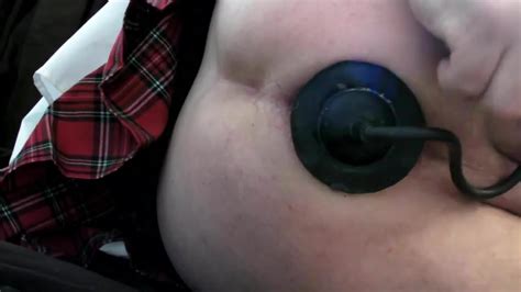 Daily Gaping Anal Stretching Gay Man Man Porn Xhamster