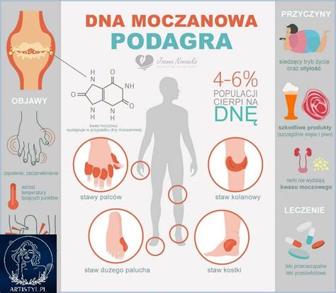 Dna Moczanowa Dieta I Jadłospisy Pdf maj 2024 artistyl pl