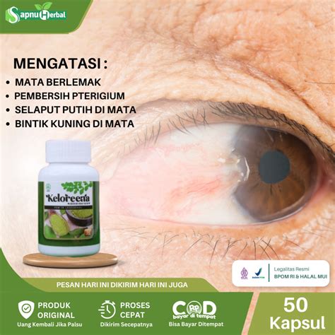 Jual Obat Mata Berlemak Mata Berlemak Kekuningan Pembersih Pterigium