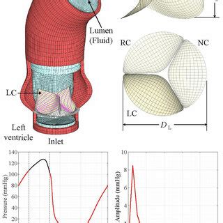 Setup For The Fsi Simulation Including The Aorta Model With The