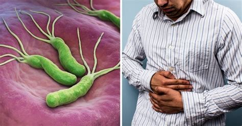 Sintomas De H Pylori No Est Mago Teste Online Tua Sa De