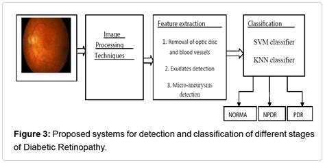 Research Development Diabetic Retinopathy