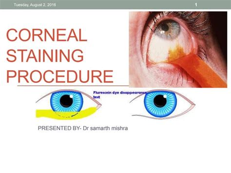 Corneal Staining Procedure Ppt