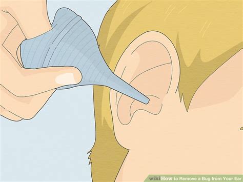 How To Remove A Bug From Your Ear Wiki Ear Health English