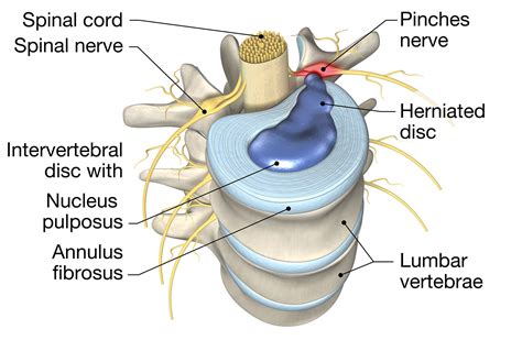 Understanding Nerve Pain Causes Symptoms And How To Get Relief