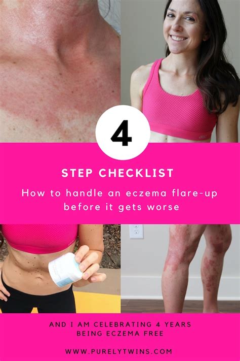 How To Handle An Eczema Flare Up Before It Gets Worse My Step Checklist