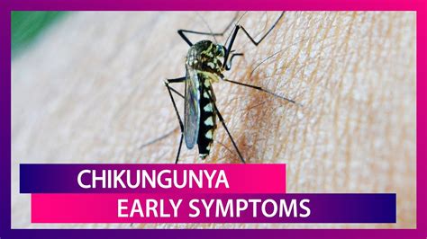 Chikungunya Symptoms From Fever To Eye Pain Signs Of This Mosquito