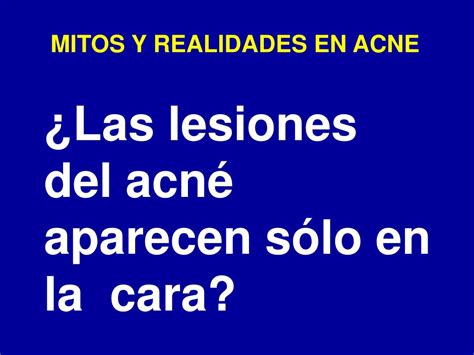 Ppt Mitos Y Realidades Del Acne Powerpoint Presentation Free