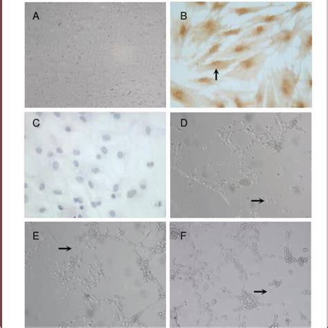 Morphology Of Neuron Like Cells Derived From Rat Bone Marrow