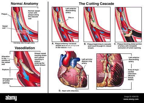 Circumflex Posterior Descending Artery Fotograf As E Im Genes De Alta