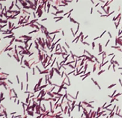 Bacillus Cereus Simple Stain