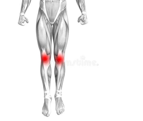 Anatom A Humana De La Rodilla Con La Inflamaci N Candente Del Punto