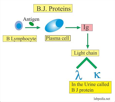 Bence Jones Proteinuria B J Proteinuria Labpedia Net