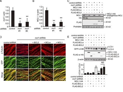 The Gsk3bmcl1 Pathway Is Involved In Injury Induced Axonal Autophagy