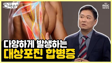 다양하게 발생하는 대상포진 합병증 통증의 공포 대상포진 ⑪ 메디컬 약손 YouTube