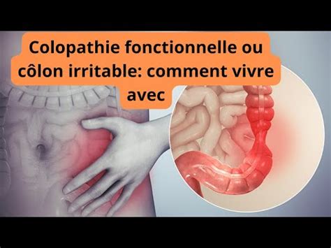 Comment Vivre Avec La Colopathie Fonctionnelle Ou C Lon Irritable