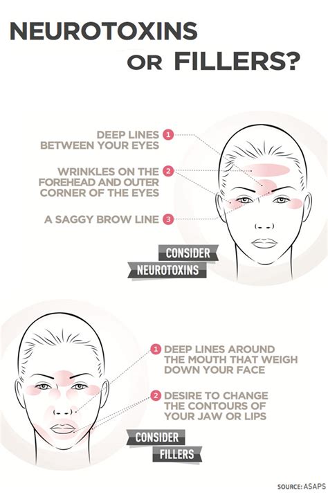 Infographic Neurotoxins Or Fillers Newbeauty