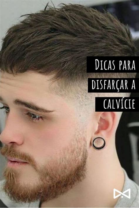 Dicas Para Disfar Ar A Calv Cie Dicas Careca Cabelo