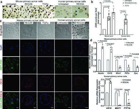 Exogenous Reg A Reg B Induces Adm In Human And Mouse Primary Acinar