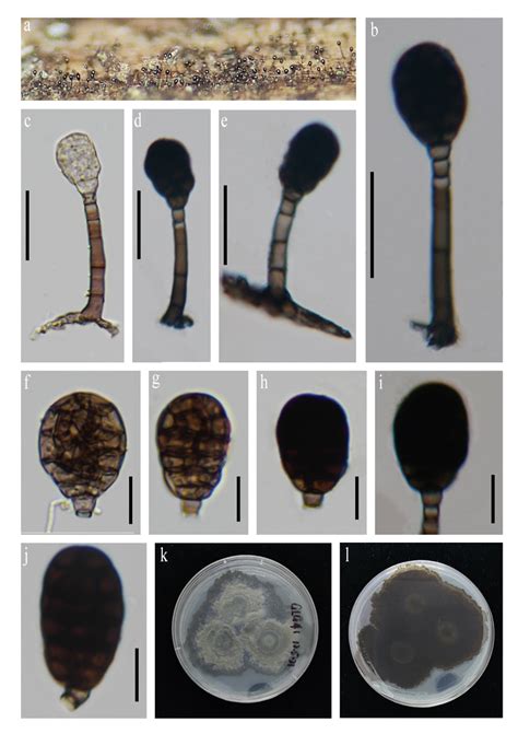 Rhexoacrodictys Melanospora Facesoffungi Number FoF 12898 Faces Of