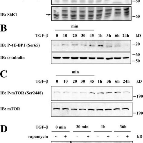 TGF β induces mTOR S6K1 and 4E BP1 phosphorylation AC NMuMG cells