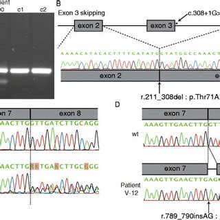 Effect Of Splice Site Mutations A Rt Pcr Using Primers In Exon And