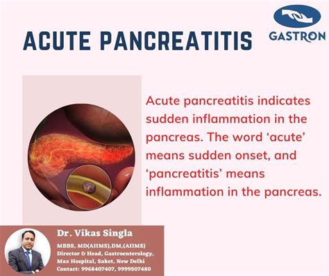 About Acute Pancreatitis - Dr. Vikas Singla