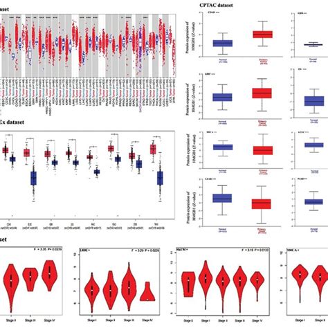 Expression And Protein Level Of Hmgb In Human Tumors A Expression