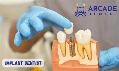 Tips To Find The Best Implant Dentist Near You