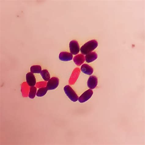 Yeast Cells In Gram Stain Fine With Microscope Stock Photo Image Of