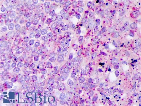 Ihc Plus Il A Polyclonal Antibody Rabbit Anti Human Lsbio