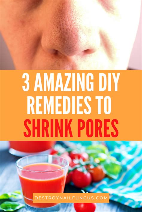 How To Shrink Pores Diy Remedies That You Can Try Right Now