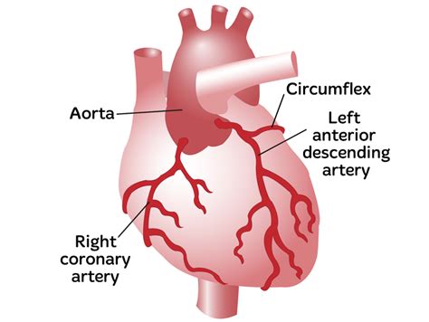 Coronary Artery Disease System Disorder Template