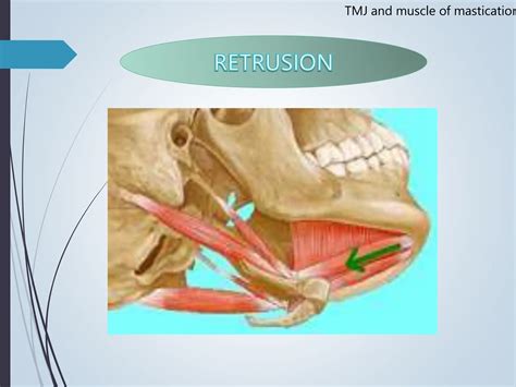 Temporomandibular Joint Muscles Of Mastication PPT