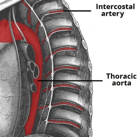 Thoracic Aortic Aneurysms - Clinical Features - Management - TeachMeSurgery